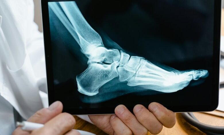 back to back missed calls analysis